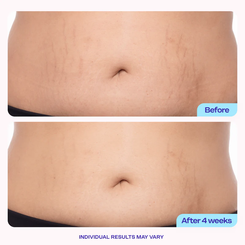 Newyuo Tighten & Smooth Belly Firming Cream