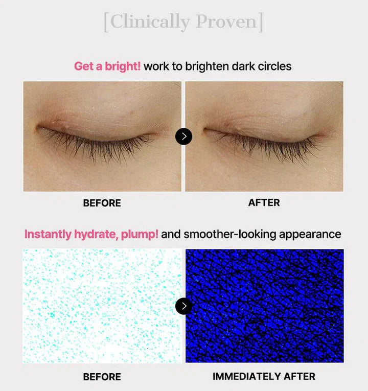 DIYSTAR Snail Hydrogel Eye Mask – Brighten, Hydrate & Firm Under-Eyes