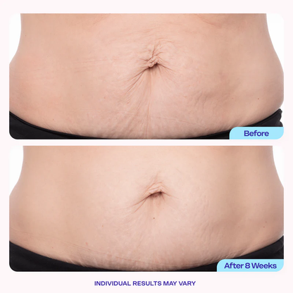 Newyuo Tighten & Smooth Belly Firming Cream