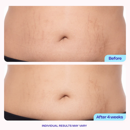 Newyuo Tighten & Smooth Belly Firming Cream